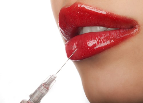 treatment of lip fillers for lip augmentation-img-blog