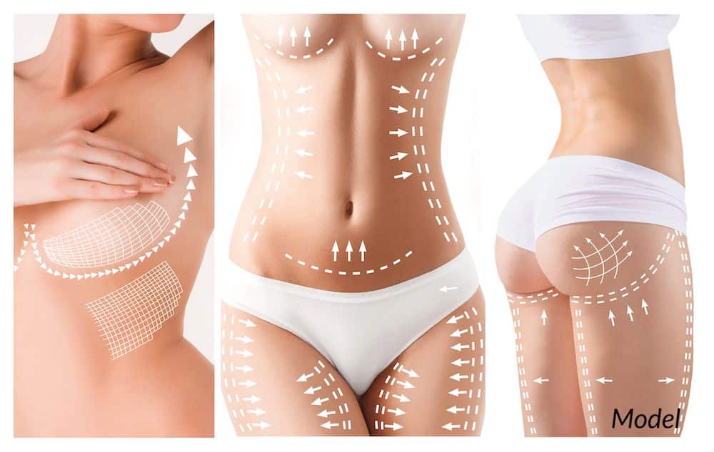 Mommy Makeover surgery restores a woman's physique with plastic surgery.