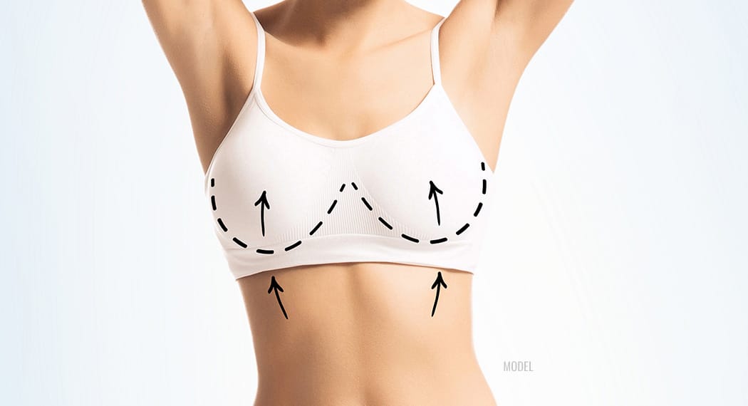 Do Your Breasts Pass the Pencil Test? - Thomas Taylor, M.D.